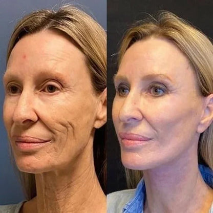 DreamLift™