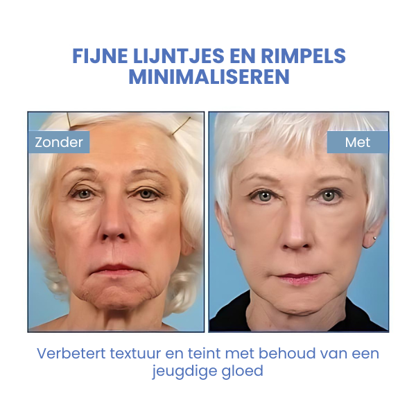 DreamLift™