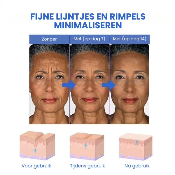DreamLift™