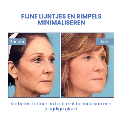DreamLift™